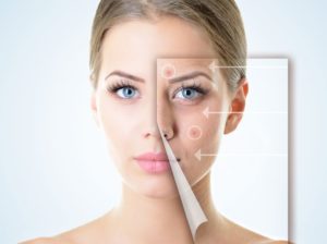 Get Acne Scar Treatment in Pimpri Chinchwad