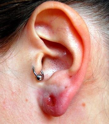 Ear Piercing