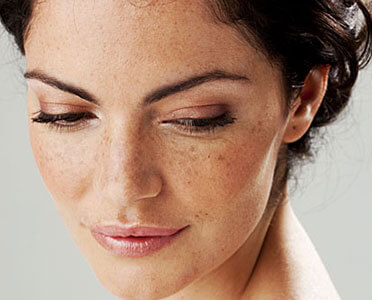 Melasma treatment in Pune